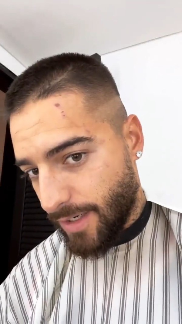 Maluma recibe mordida de su perro Buda, un  dóberman